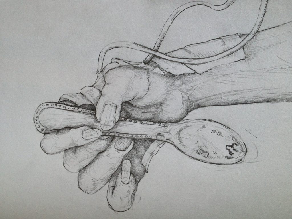 Pencil drawing while in ICU at ch